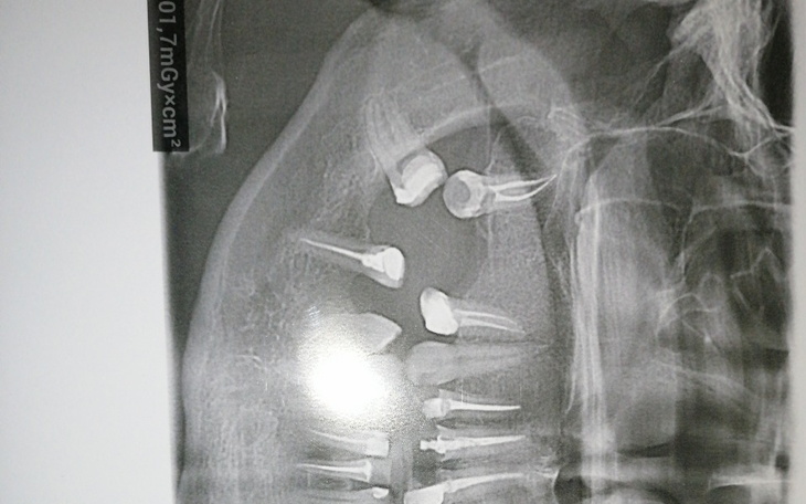 Zbiórka Leczenie implantologiczne - zdjęcie główne