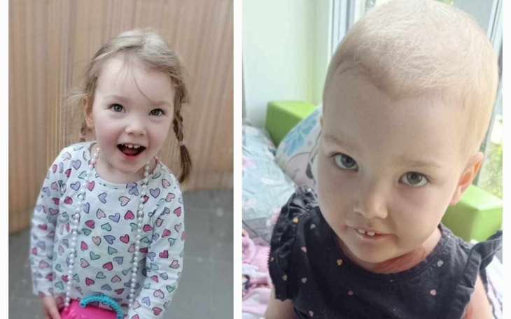 Dwie dziewczynki, jedna uśmiechnięta, druga po leczeniu, pokazujące siłę i nadzieję.