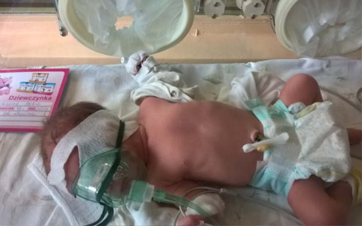 Zbiórka Dla chorej dziewczynki - zdjęcie główne