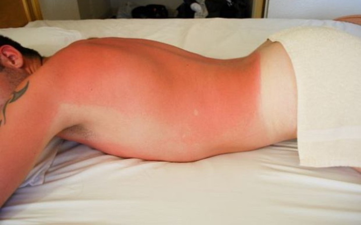 Zbiórka Krem do opalania Nie jeden - zdjęcie główne