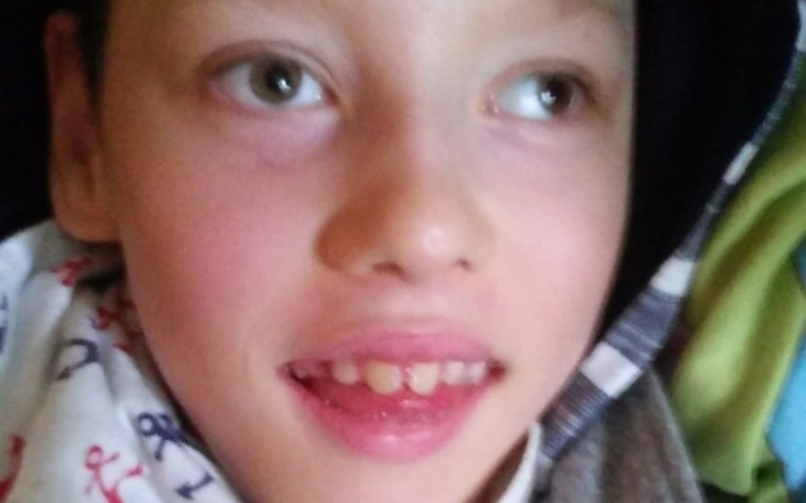 Zbiórka Nóżki Mikołaja - zdjęcie główne