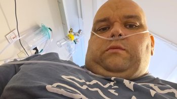 Zbiórka Erni walczy o zdrowie! - miniaturka zdjęcia