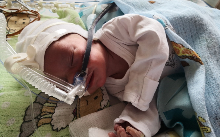 Zbiórka Lżejszy oddech dla Mikołaja - zdjęcie główne