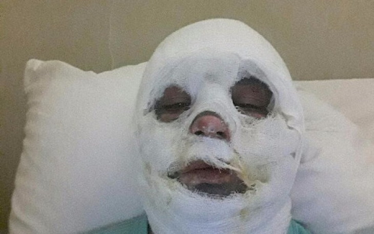 Osoba w szpitalu z opatrunkiem na twarzy, wyraz cierpienia.