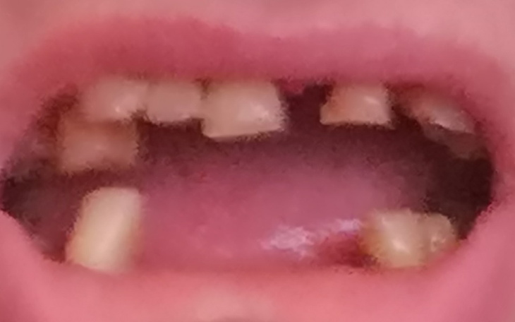 Zbiórka Na nowe kły w mojej paszczy - zdjęcie główne