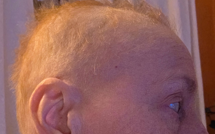 Zbliżenie na głowę osoby z krótkimi, jasnymi włosami.