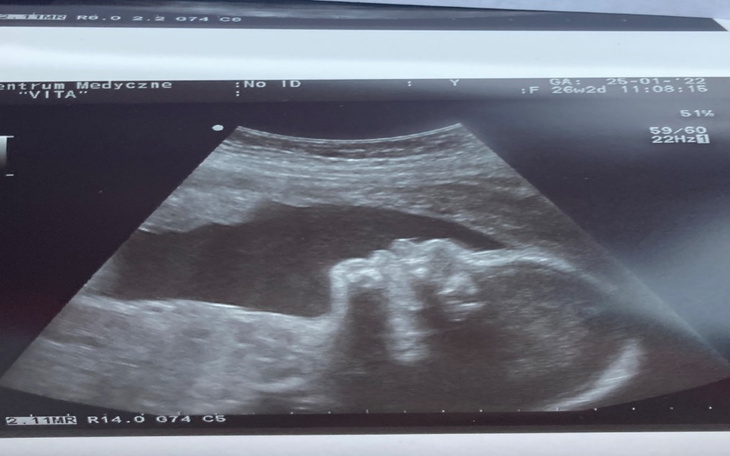 Zbiórka pomóż ciężarnej wyjść z długów - zdjęcie główne