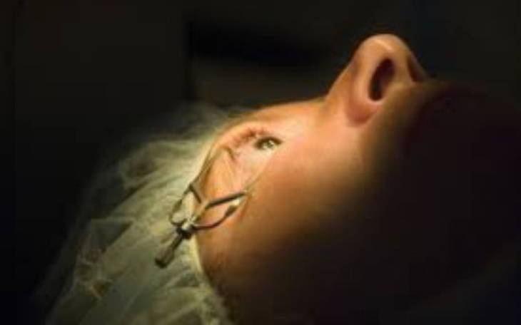 Zbiórka pomoc dla oczu - zdjęcie główne