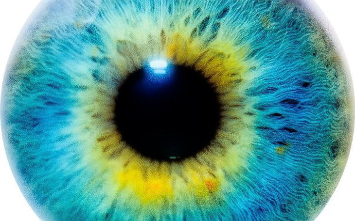 Zbiórka na operację chorego oka - zdjęcie główne