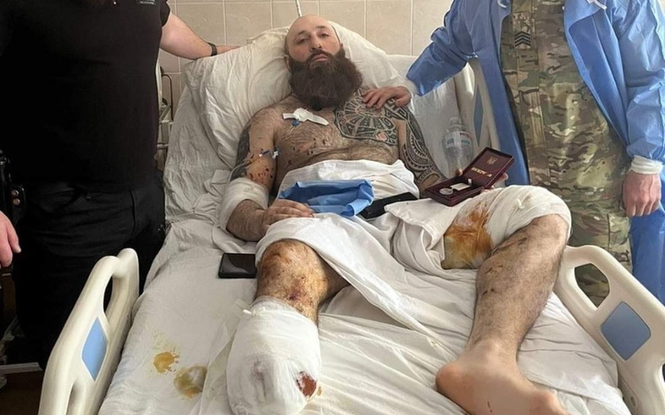 Mężczyzna w szpitalu z poważnymi obrażeniami, otoczony przez personel medyczny.