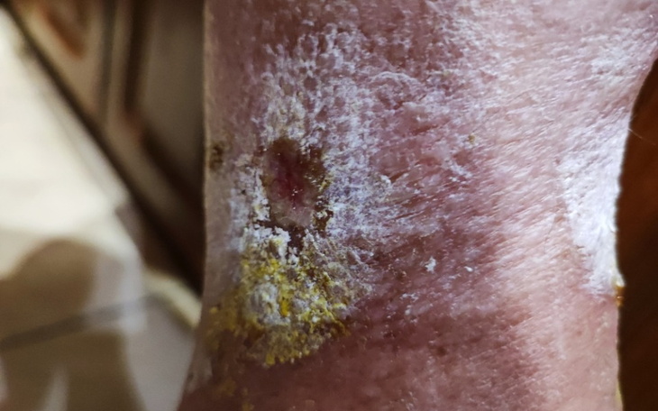 Zbiórka Schorowana Barbara - zdjęcie główne