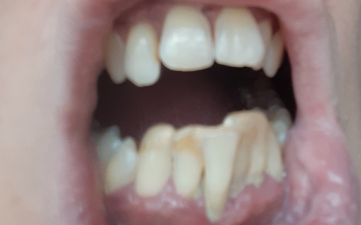 Zbiórka Na zęby aby się trzymały - zdjęcie główne