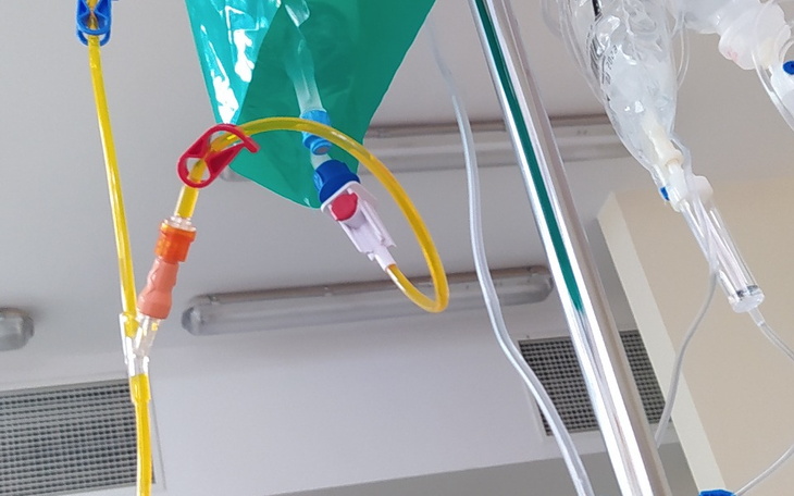 Widok na kroplówkę w szpitalu, z rurkami i płynami.