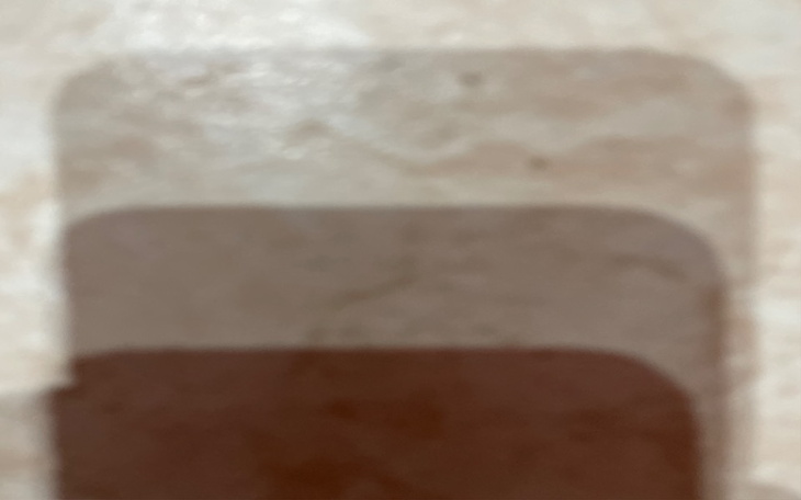 Zbiórka Na normalne życie, bez kłopotu - zdjęcie główne