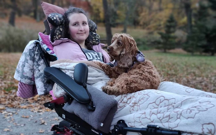 Zbiórka POMÓŻ MI uratować moją nogę - zdjęcie główne