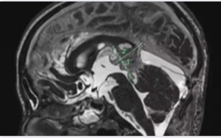 Zbiórka Walka z guzem - zdjęcie główne