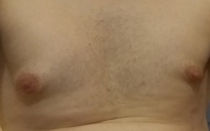 Zbiórka Zbiorka na operacje - zdjęcie główne