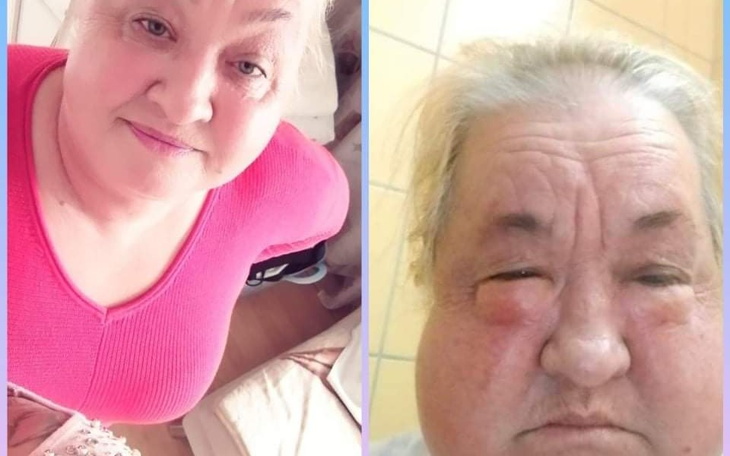 Zbiórka Pomóż mi odzyskać głos .,.. - zdjęcie główne