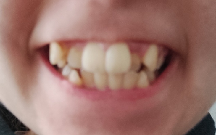 Zbiórka Aparat na zęby dla Marii - zdjęcie główne