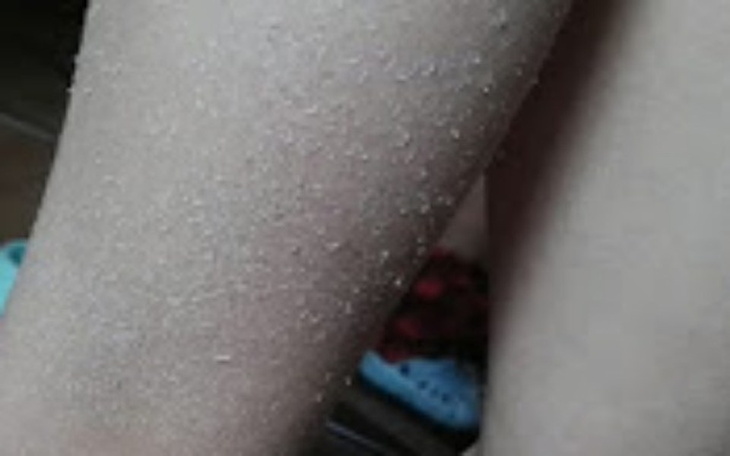 Zbiórka Specjalistyczne maści - zdjęcie główne