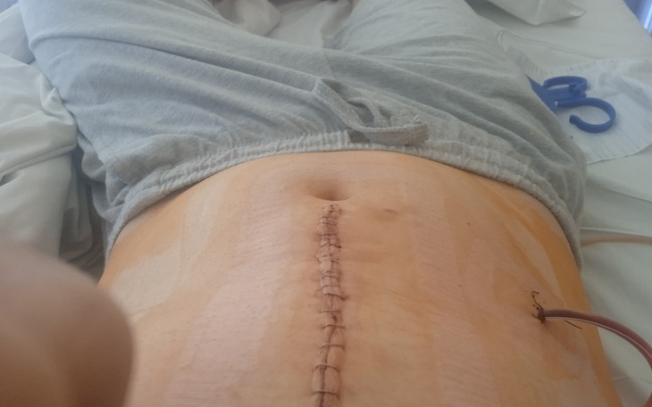 Zbiórka Tata bliźniaków walczy z Rakiem - zdjęcie główne