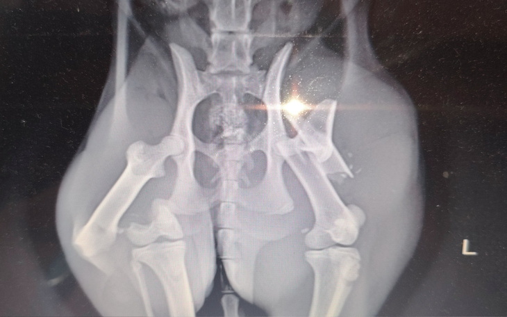 Zdjęcie rentgenowskie przedstawiające kości w okolicy miednicy.