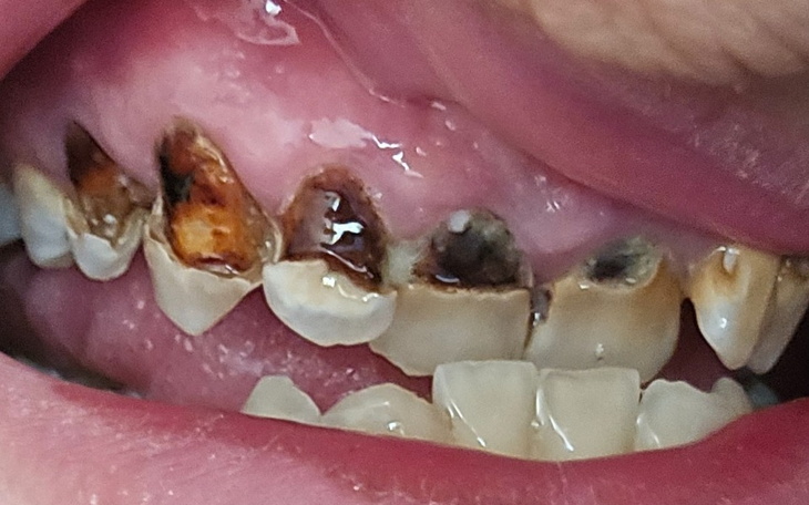 Zbiórka Na Leczenie Stomatologiczne .. - zdjęcie główne