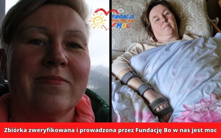 Zdjęcie kobiety leżącej w łóżku, z opaską na ręce.