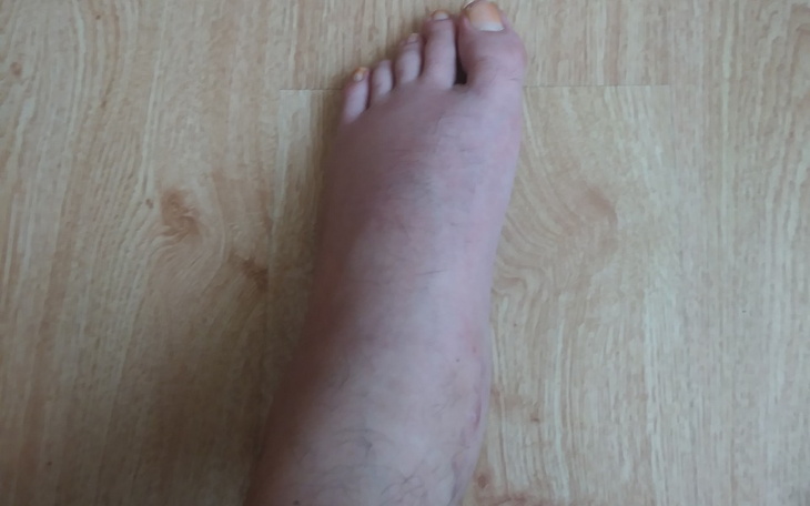 Zbiórka Na dalesze leczenie - zdjęcie główne