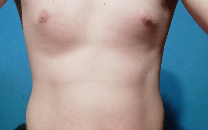 Zbiórka Zbiórka na siłkę - zdjęcie główne