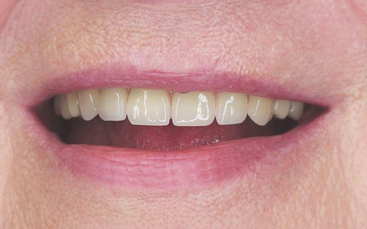 Zbiórka Proteza111 - zdjęcie główne