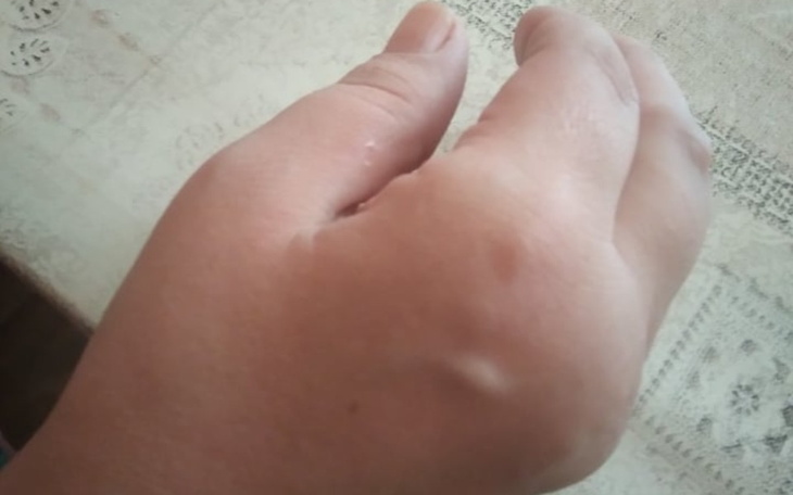 Zbiórka Leczenie chorej mamy na rzs - zdjęcie główne