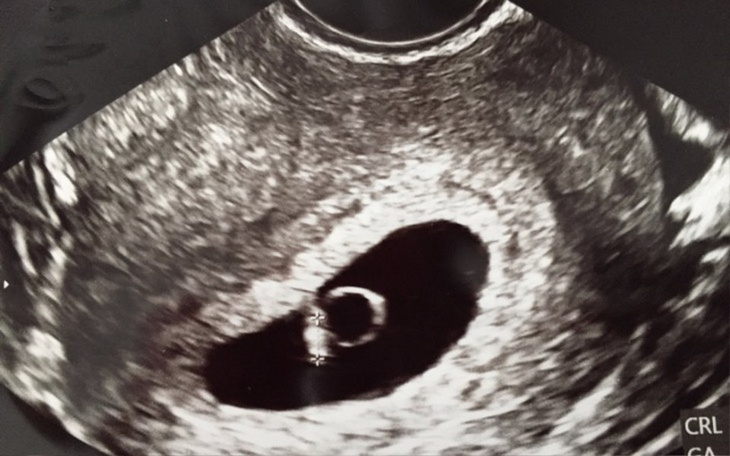 Zbiórka IN VITRO walka o marzenie - zdjęcie główne