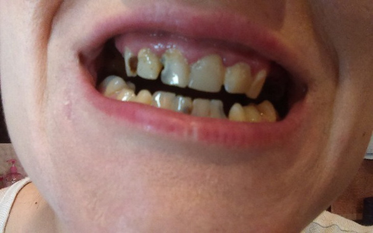 Zbiórka Zbieram na nowe zęby - zdjęcie główne