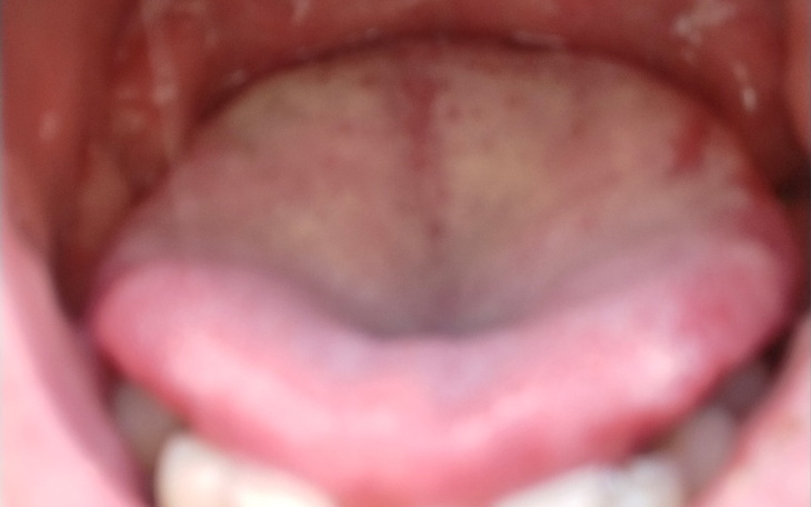 Zbiórka Zbieram na zęby,implanty - zdjęcie główne