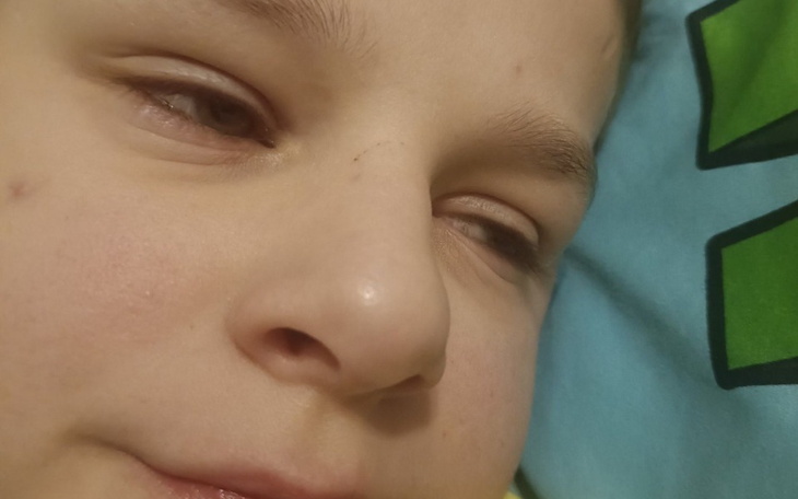 Zbliżenie na twarz dziecka leżącego na poduszce.