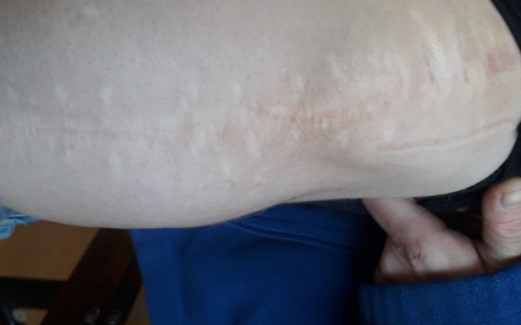 Zbiórka Na operacje lewego stawu biodra - zdjęcie główne