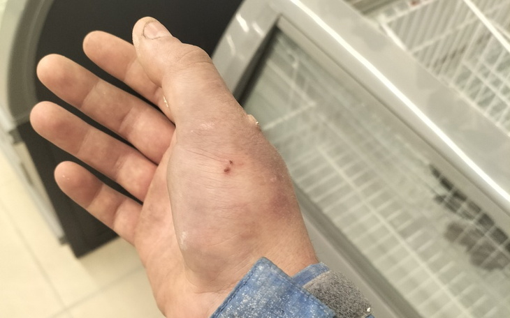 Zbiórka Na szpital mam złamaną kość - zdjęcie główne