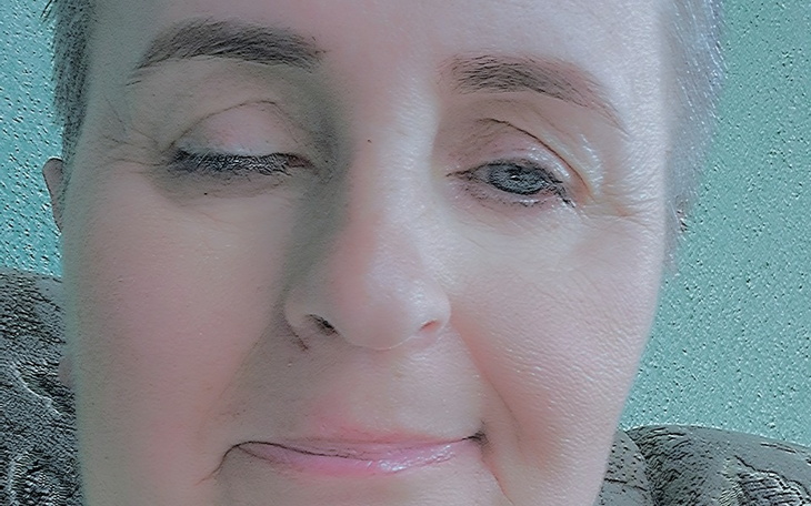 Zbiórka Rehabilitacja po operacji guza . - zdjęcie główne