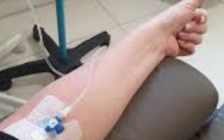 Zbiórka Na operację guza piersi - zdjęcie główne