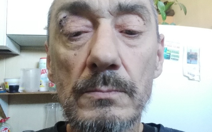 Zbiórka Dla Seweryna - zdjęcie główne