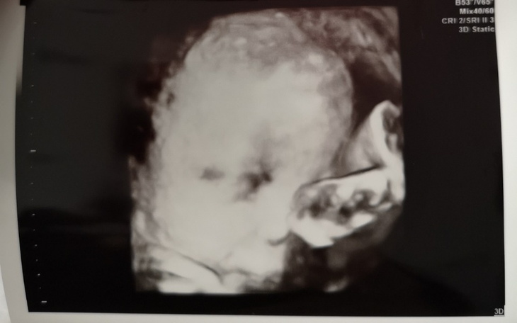 Zbiórka Pomoc finansowa na dziecko - zdjęcie główne