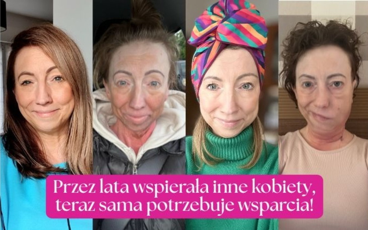 Kobieta na zdjęciach, pokazująca swoją przemianę i potrzebę wsparcia.