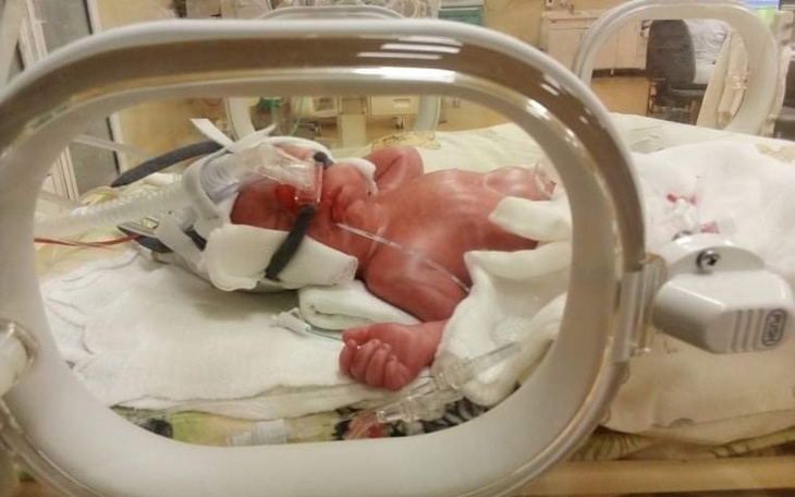 Zbiórka Na rehablitacjie dla bliżniaków - zdjęcie główne