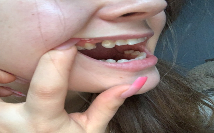 Zbiórka piękny uśmiech moim marzeniem - zdjęcie główne