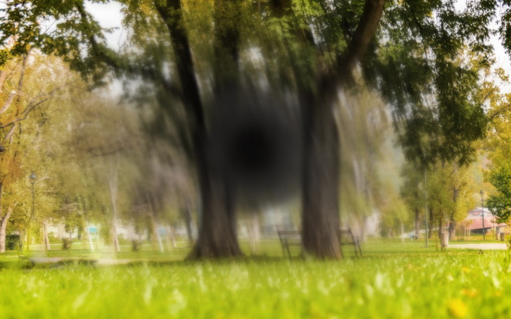 Zbiórka AMD zwyrodnienie plamki żółtej - zdjęcie główne