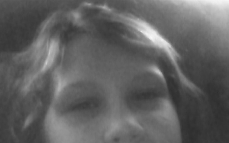 Zbiórka na operacje na oczy siostry - zdjęcie główne