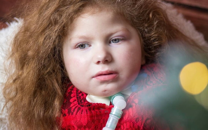 Mała dziewczynka z długimi włosami, w czerwonej sukience, z tracheostomią.