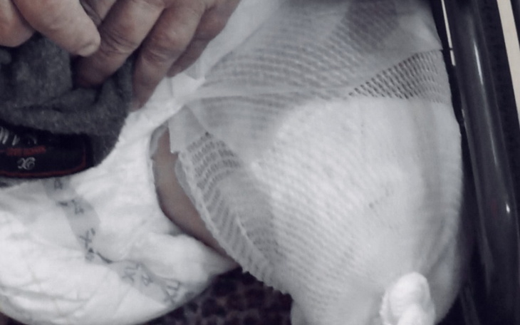 Zbiórka Proteza dla taty, rehabilitacja - zdjęcie główne