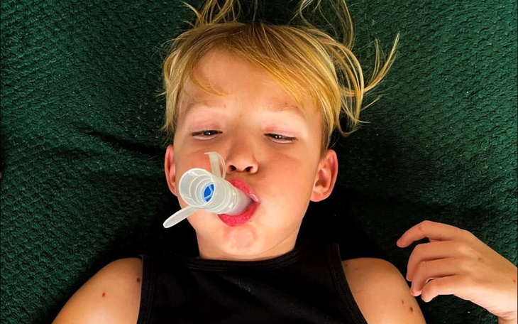 Zbiórka Leczenie Zaczarowanego Dziecka - zdjęcie główne